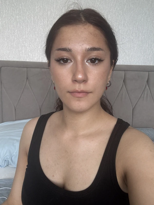 Common photo 15